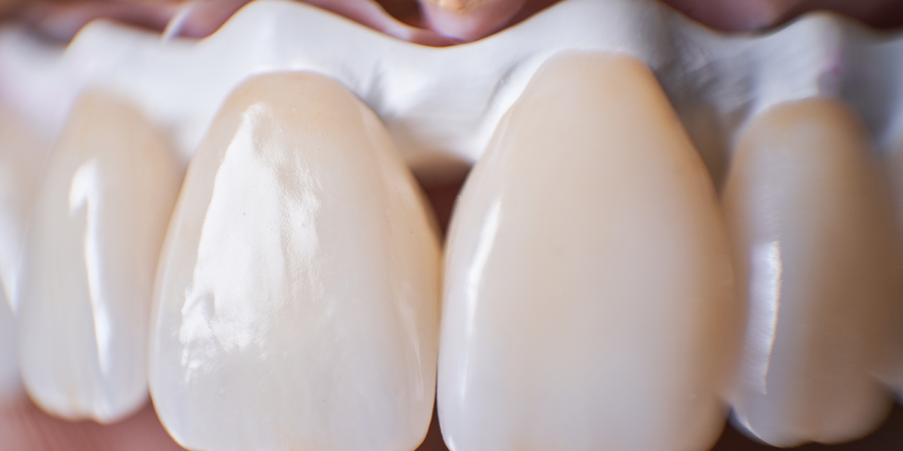 The Importance of Keeping Your Tooth Enamel Healthy