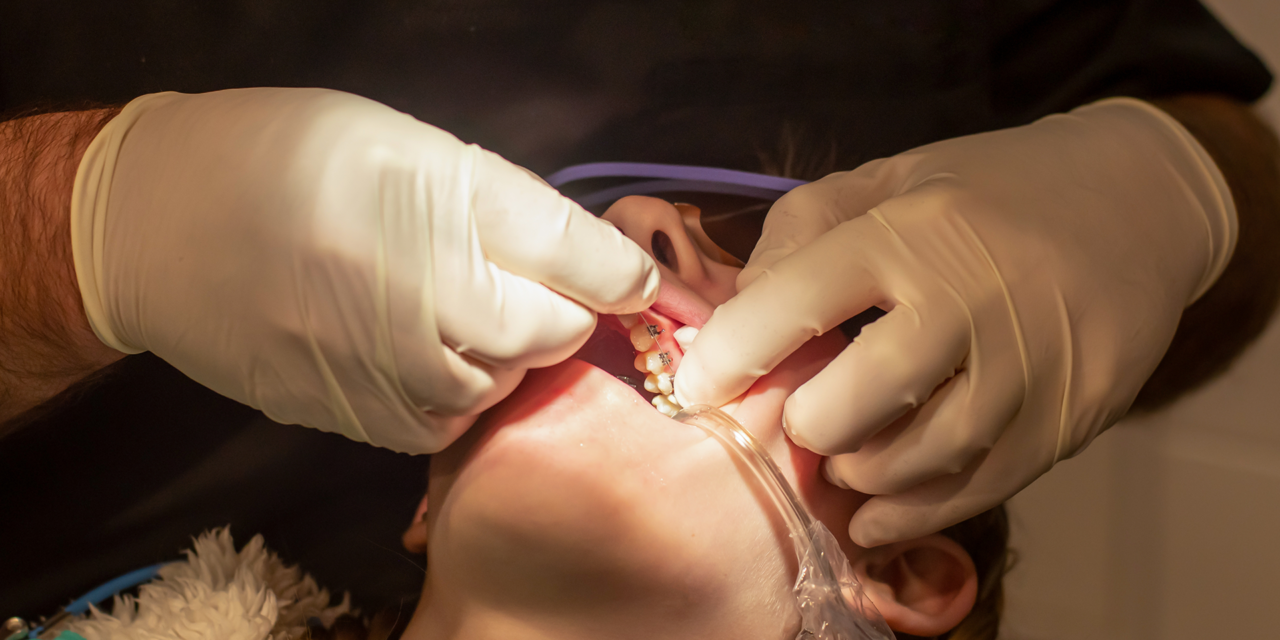 Straightening Teeth: Different Orthodontic Treatments Explained