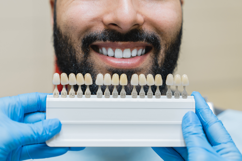 Dental Implants: A Comprehensive Guide