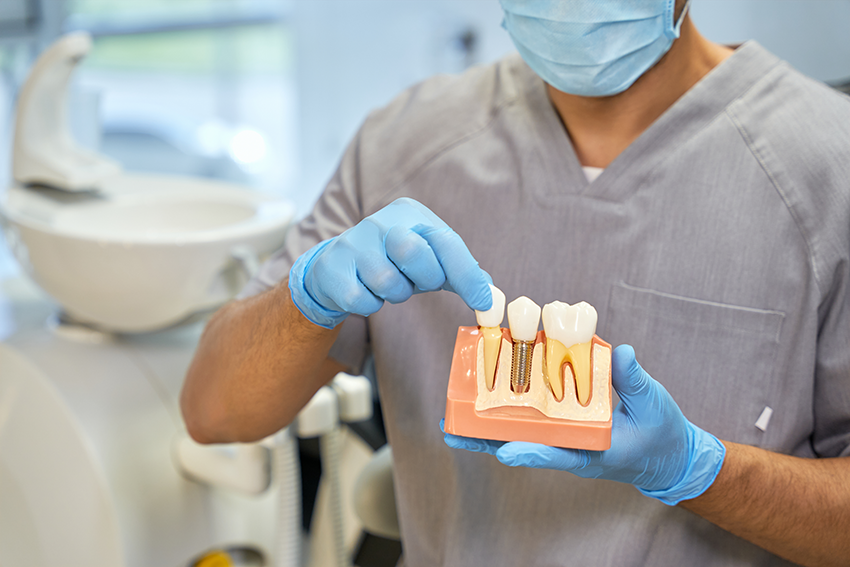 Dental Implants: A Permanent Solution